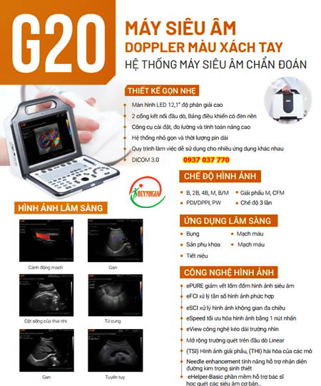 may sieu am doppler mau xach tay g20(2)