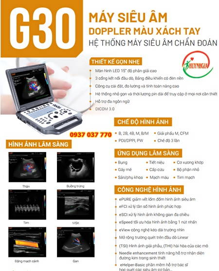 may sieu am doppler mau xach tay g30